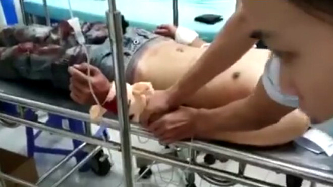 Mang bia đi mời, nam thanh niên bị chém gần đứt lìa hai tay ảnh 2