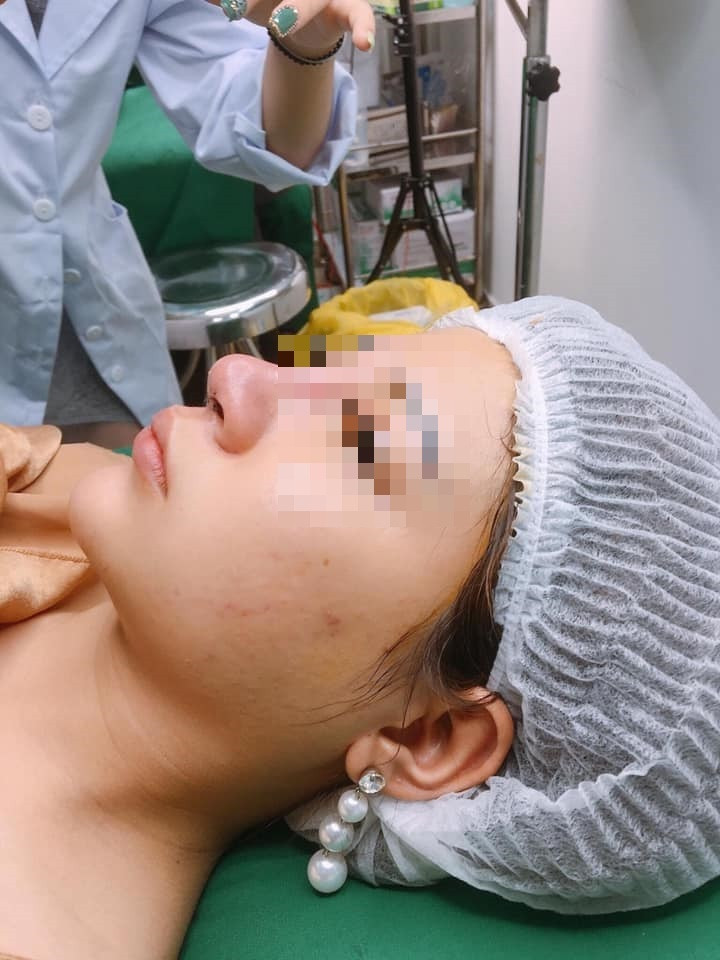 Một phụ nữ nguy kịch nghi sốc phản vệ khi gây mê nâng mũi ảnh 1