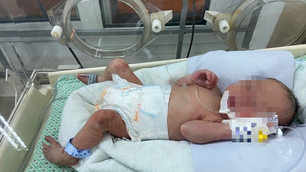 Mẹ bé sơ sinh bị bỏ rơi giữa khe tường là sinh viên năm thứ 2 ảnh 2