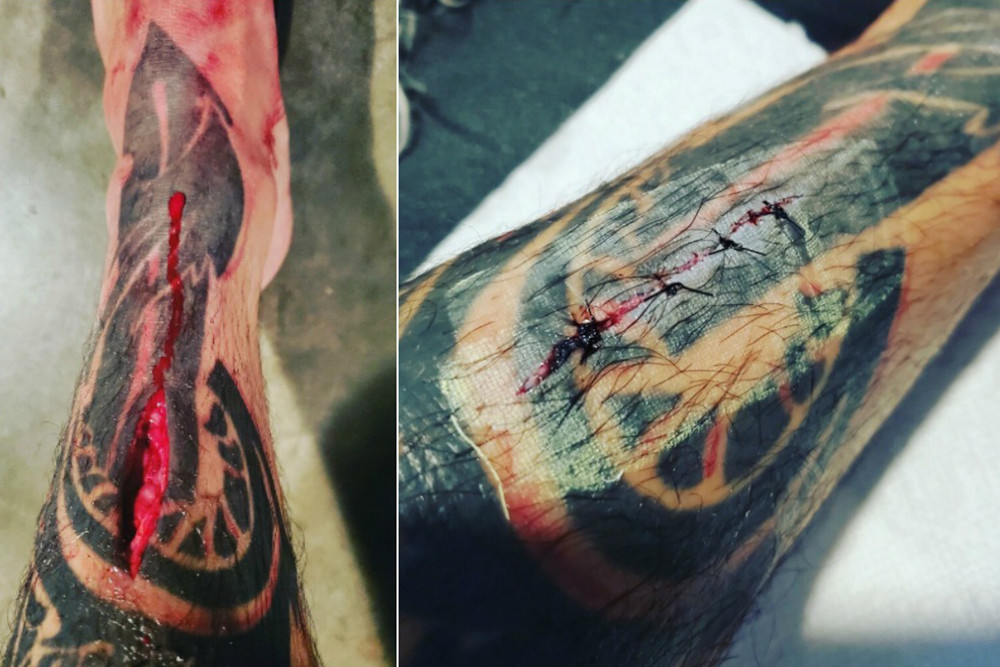 Tăng hạng cân, võ sĩ MMA dính chấn thương kinh dị ảnh 1