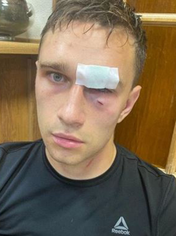 Cựu đội trưởng tuyển Nga tung cú đấm, trọng tài đổ gục trên sân ảnh 1