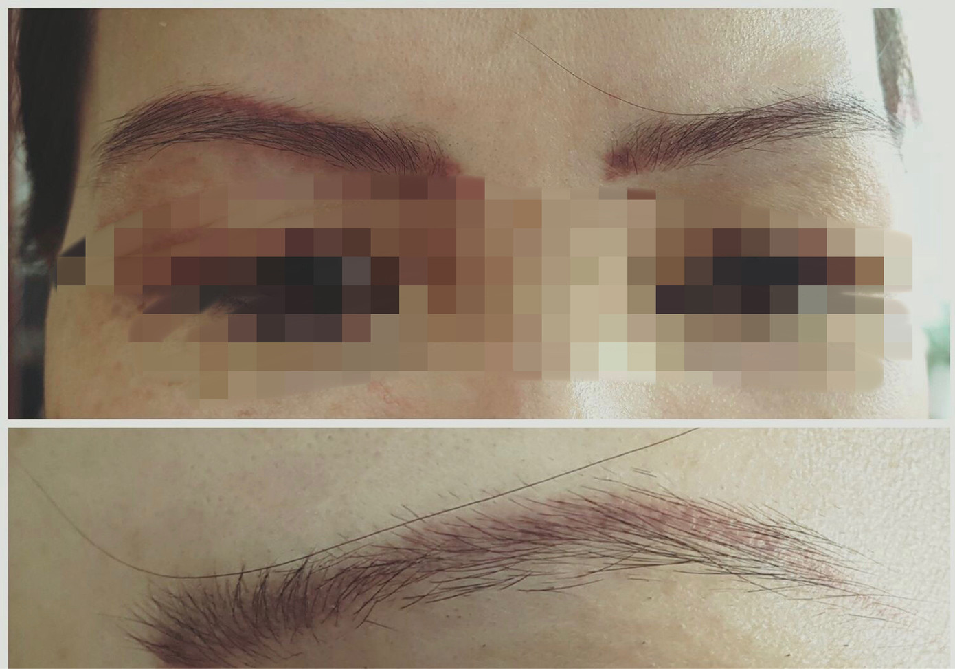 Người phụ nữ nguy kịch sau xăm lông mày đã tử vong ảnh 1