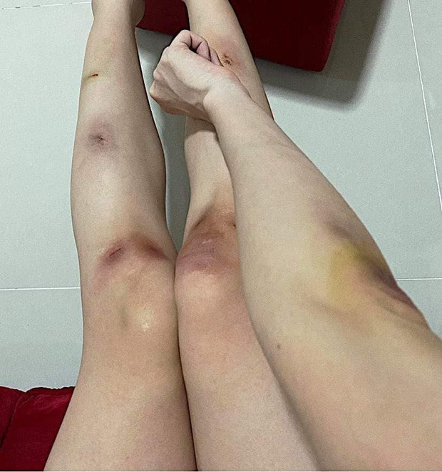 Vì sao danh hài Hoài Linh tiết lộ muốn ở phòng trọ hơn khách sạn? ảnh 2