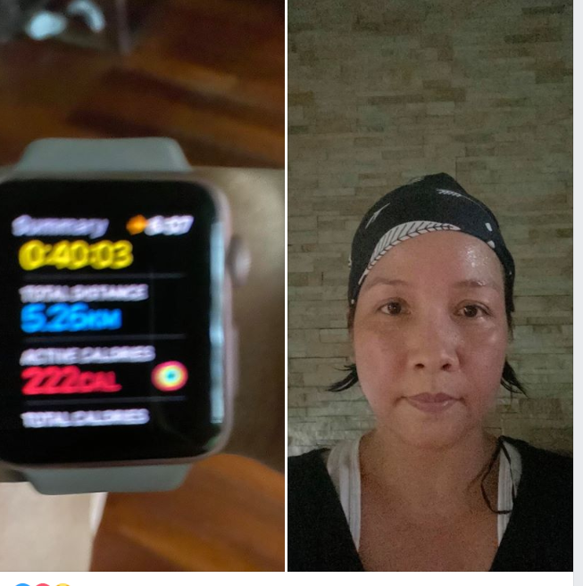 Fan hoảng hốt trước ảnh Hiền Hồ nhợt nhạt, lưng chằng chịt vết đỏ tím ảnh 2