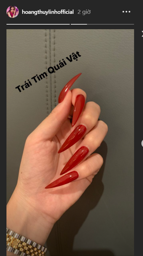 Diễn viên Bình An tung ảnh mặt sưng vù khác lạ ảnh 9