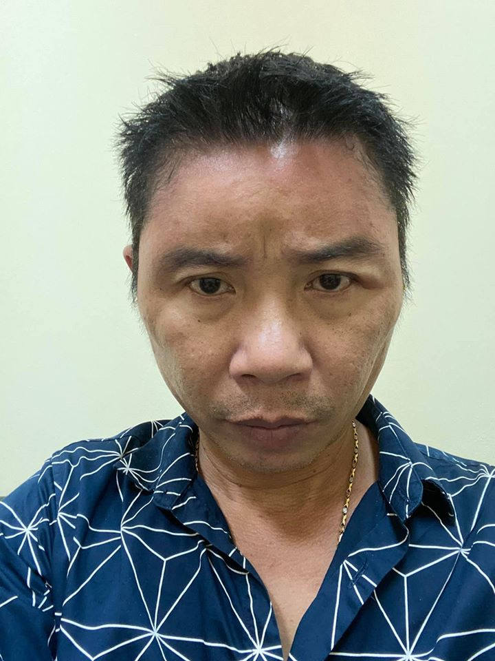 'Hốt hoảng' trước gương mặt sưng vù của NSND Công Lý ảnh 1