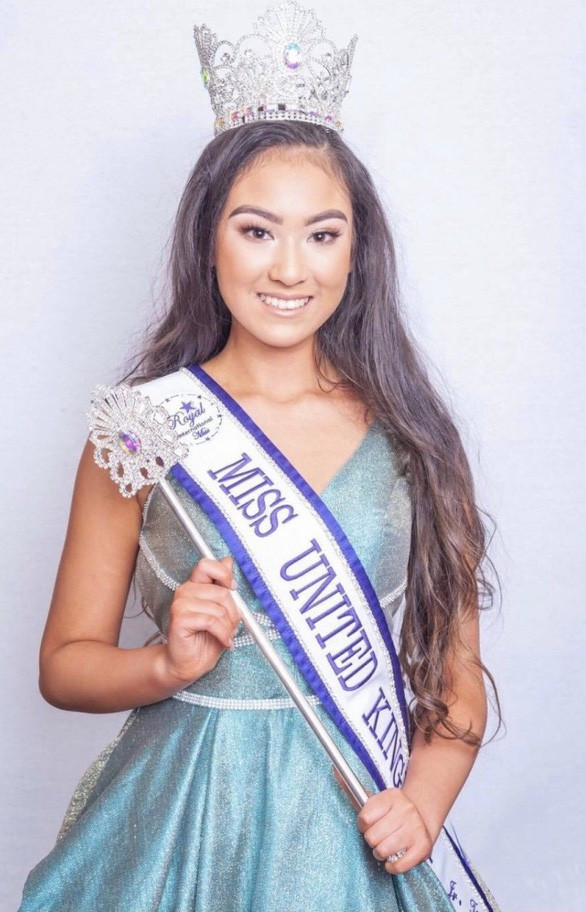 Showbiz 5/3: Người mẫu Scotland bị tấn công vì bức ảnh hở vòng 1 ảnh 4