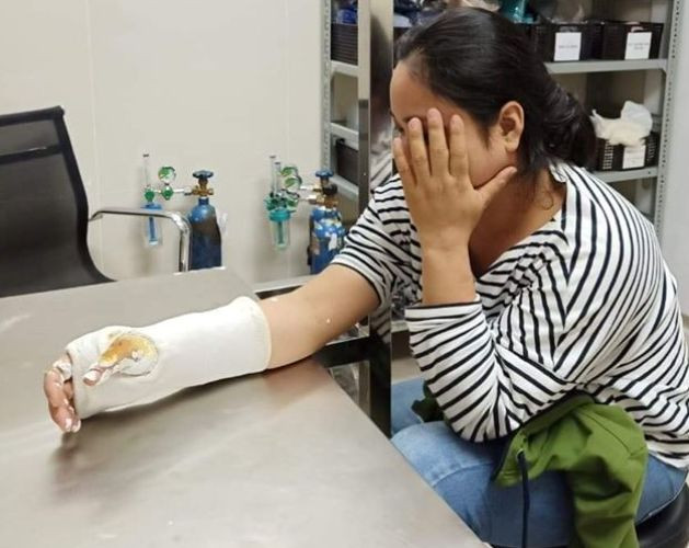 Người phụ nữ bị đạp ngã, cướp xe máy giữa ban ngày ảnh 1