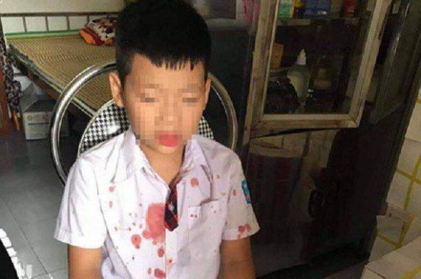 Nhà trường nói gì vụ người đàn ông đấm hộc máu mồm học sinh lớp 1 ảnh 1