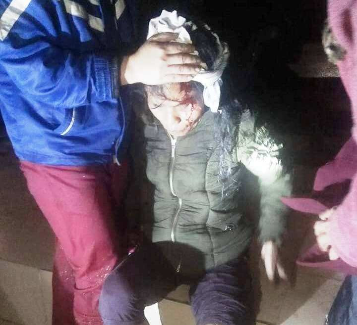 Lốc xoáy tàn phá miền núi Nghệ An, cụ bà bị nhà sập đè gãy chân ảnh 1