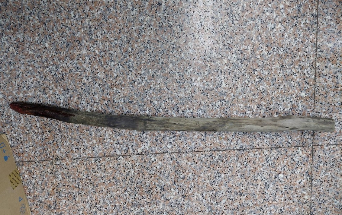 Người đàn ông mang cả cây gỗ xuyên từ tầng sinh môn đến bụng nhập viện ảnh 2