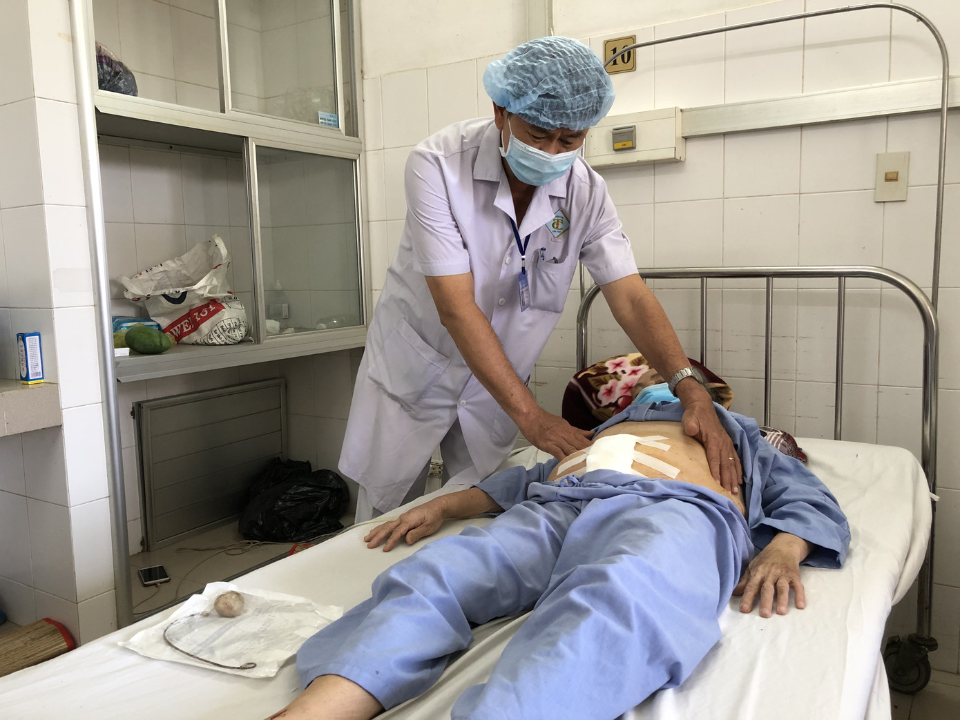 'Quên' ống sonde trong cơ thể suốt 9 năm, cụ bà bị sỏi bám to bằng quả trứng ảnh 1