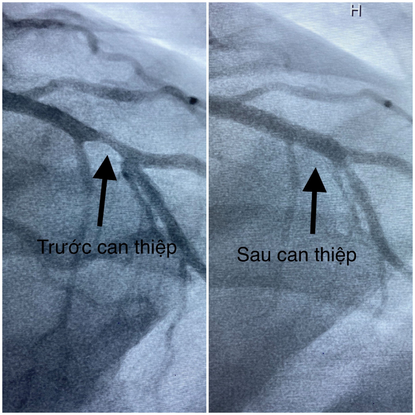 Cứu bác sĩ '10 phần chết' sau khi tim ngừng đập 1,5 giờ ảnh 1