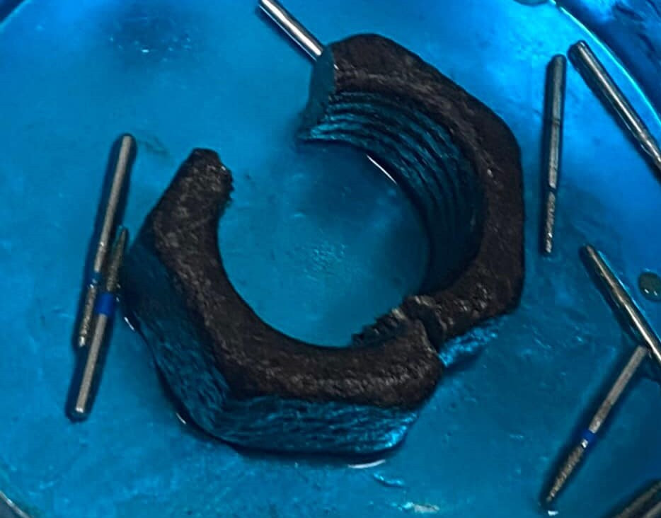 Chơi dại, nam thanh niên tự nhét ‘của quý’ vào đai ốc lục giác ảnh 1