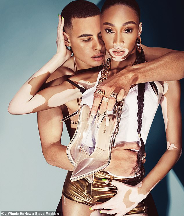 Siêu mẫu bạch biến gây ngỡ ngàng với vóc dáng hoàn hảo khó rời mắt ảnh 3