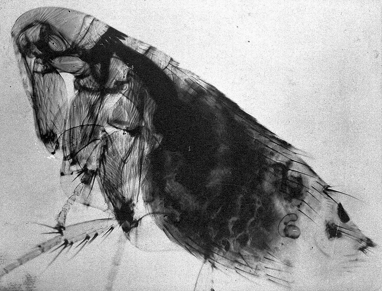 [HỒ SƠ] Hai người Trung Quốc mắc căn bệnh từng giết 30-60% dân số châu Âu ảnh 2