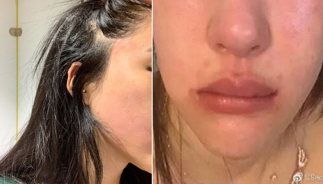 'Bản sao 19 tỷ' của AngelaBaby tố bị CEO bạo hành sưng bầm mặt ảnh 1