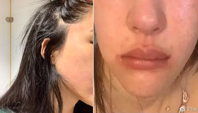 'Bản sao 19 tỷ' của AngelaBaby tố bị CEO bạo hành sưng bầm mặt ảnh 1