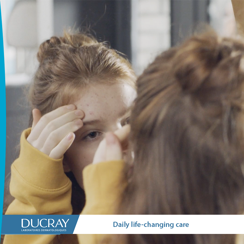 Những hậu quả khi điều trị mụn không đúng cách: 'Sai một li…đi luôn gương mặt'! ảnh 1