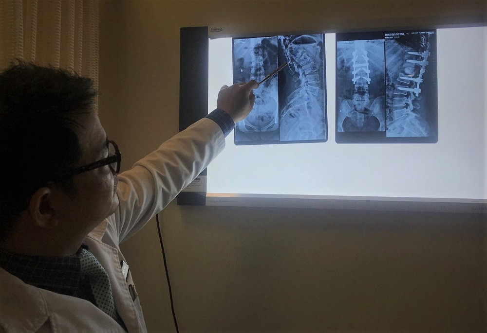 Duỗi thẳng người gù 45 độ với ca mổ '3 trong 1' ảnh 1