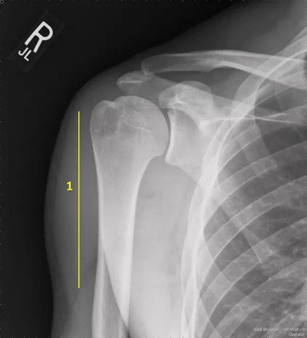 1001 thắc mắc: Kỳ lạ vì sao em bé lắm xương hơn người lớn? ảnh 2