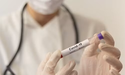 Đà Nẵng bắt đầu giãn cách xã hội: Ra ngoài mang khẩu trang, quán xá thưa vắng khách ảnh 16