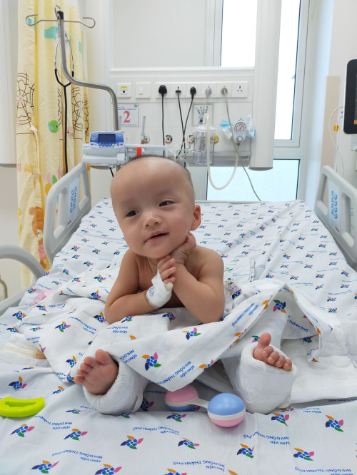 Trúc Nhi, Diệu Nhi sau một tháng mổ tách ảnh 1