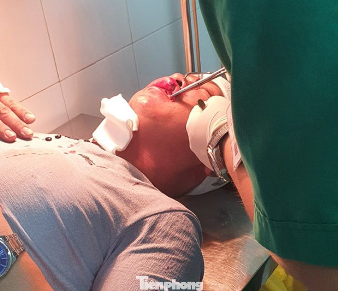 Nhiều người gặp nạn khi đi qua dự án đường 'nghìn tỷ' ảnh 5