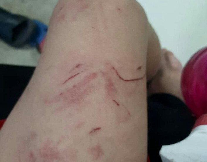 Bình Dương: Khỉ tấn công người dân, học sinh rồi lao lên cây chạy trốn ảnh 2