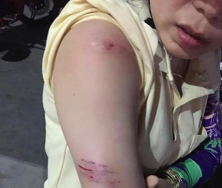 Bình Dương: Khỉ tấn công người dân, học sinh rồi lao lên cây chạy trốn ảnh 1