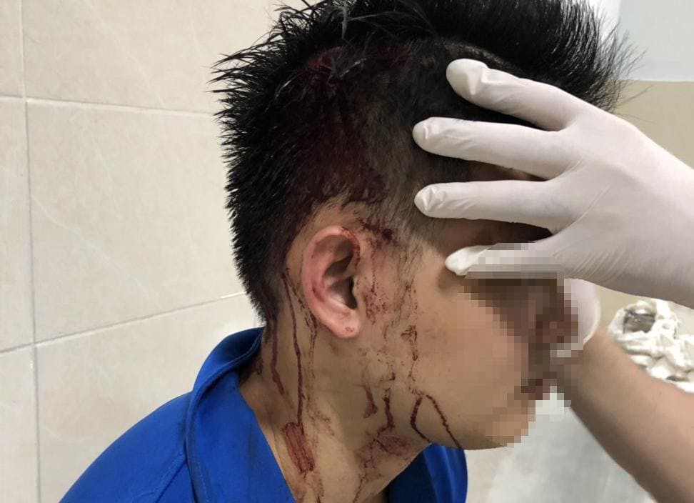 Hỗn chiến trước trung tâm thương mại, thanh niên bị súng bắn trúng đầu ảnh 1