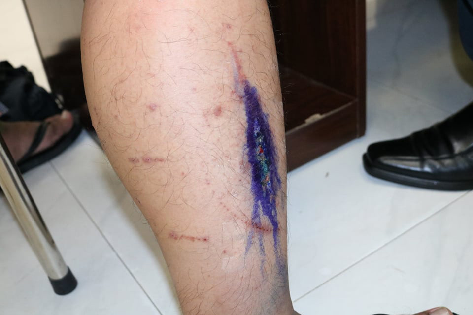 Kiến ba khoang tấn công người dân Sài Gòn đầu mùa mưa ảnh 2