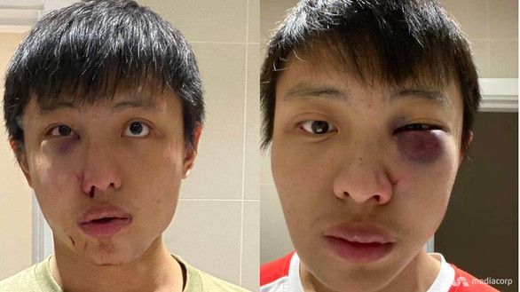 Sinh viên châu Á nghi bị tấn công ở London vì phân biệt chủng tộc dịch Covid-19 ảnh 1