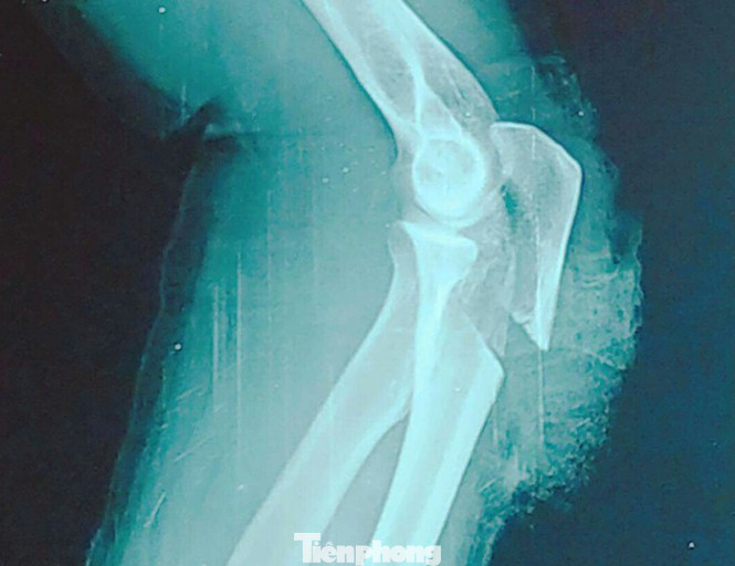 Nghĩ hàng xóm tụ tập nói xấu mình, thanh niên vác dao qua chém loạn xạ ảnh 2