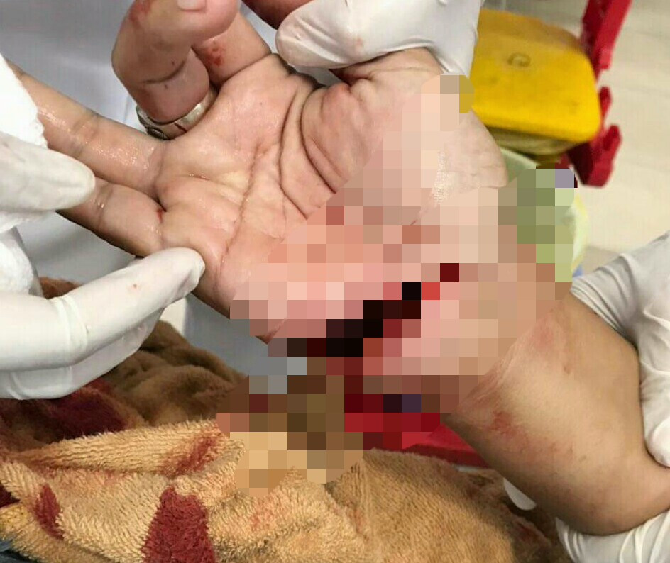 Không đổi vé số trúng thưởng, chủ đại lý bị 5 người chém gục ảnh 2