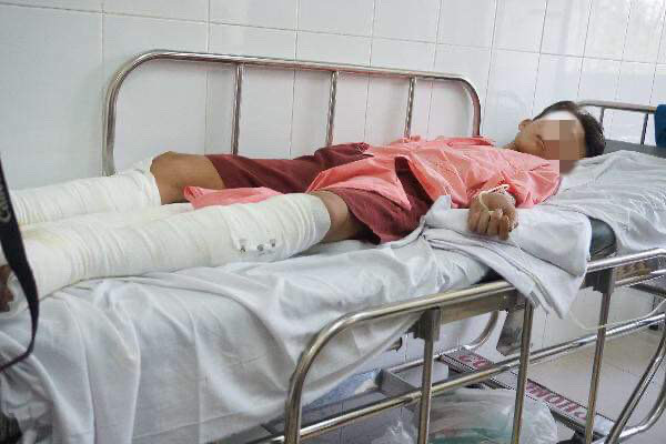 Hút thuốc lá trong lúc đang chiết xăng, 4 người nguy kịch ảnh 2