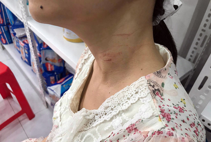 Hơn một giờ kinh hoàng của 3 người bị gã 'ngáo đá' dùng băng dính trói chặt, kề dao vào cổ ảnh 1