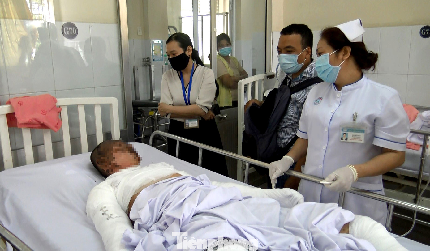 Cháy toàn thân, hỏng mắt do lên mạng học cách chế pháo nổ chơi Tết ảnh 1