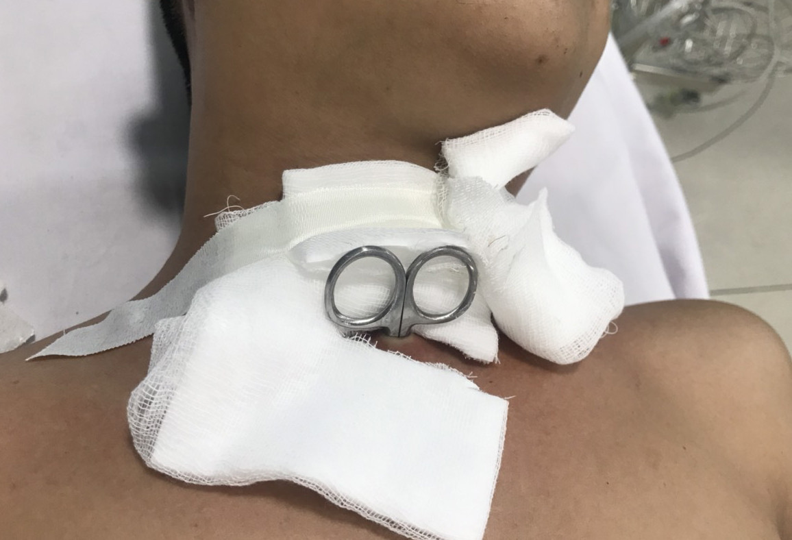 Xét nghiệm COVID-19 khẩn cấp để mổ cấp cứu người đàn ông tự dùng kéo đâm xuyên cổ ảnh 1