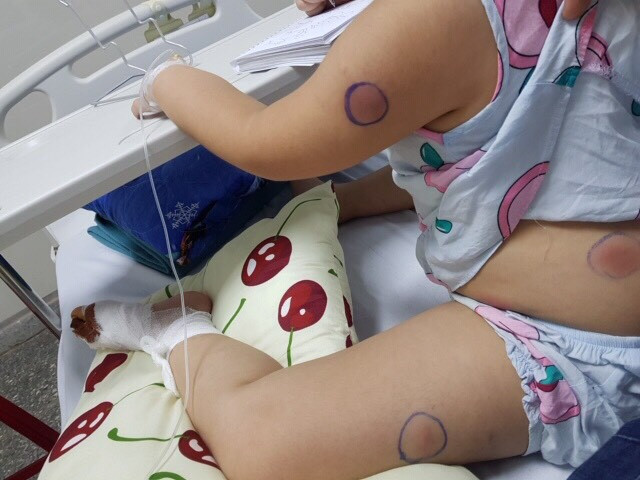 Hà Nội: Bệnh nhân ra viện được 4 ngày lại tái dương tính SARS-CoV-2 ảnh 3