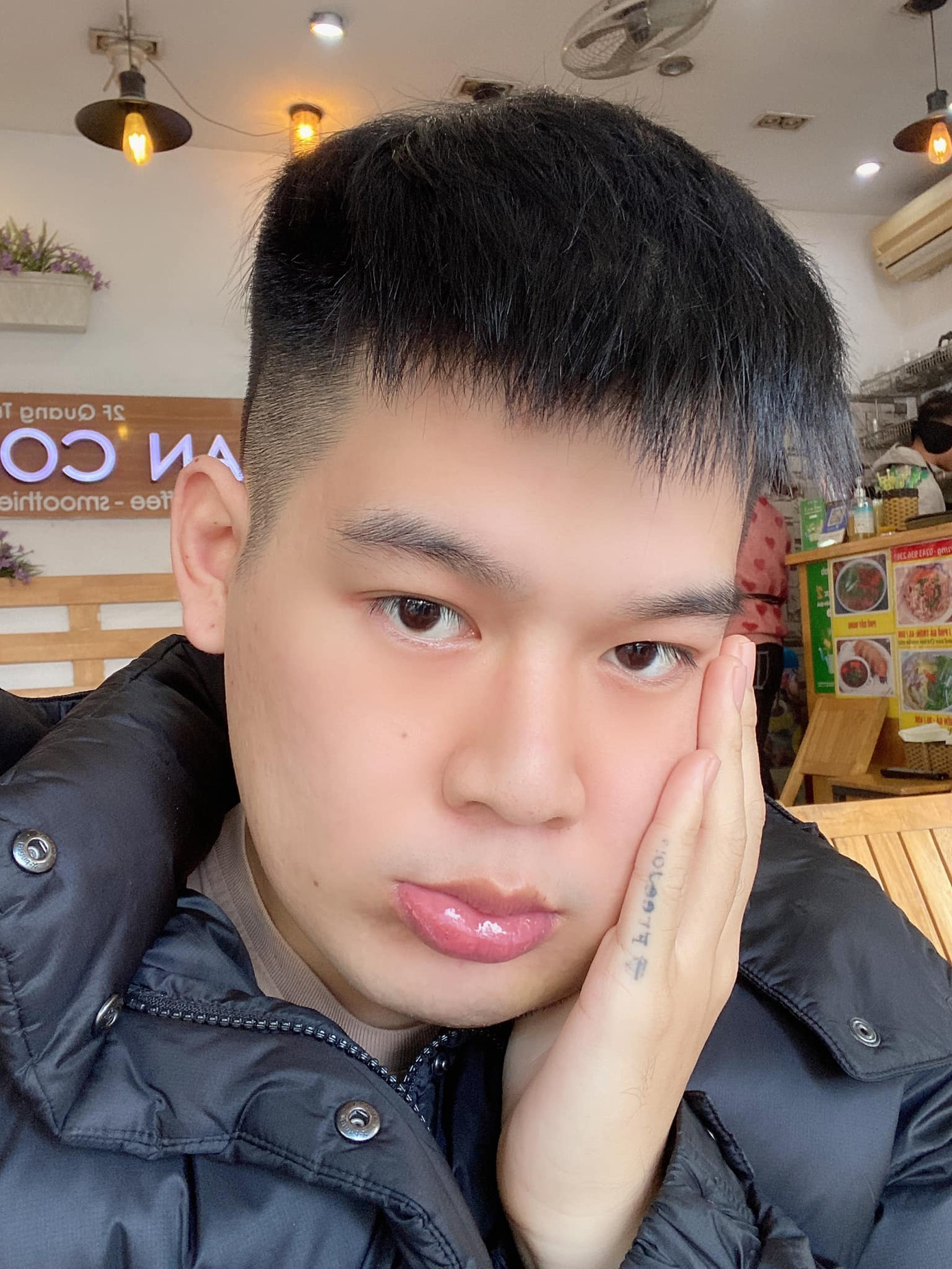 Hot TikToker Long Chun giữ tinh thần lạc quan sau 1 tháng điều trị u men xương hàm ảnh 1