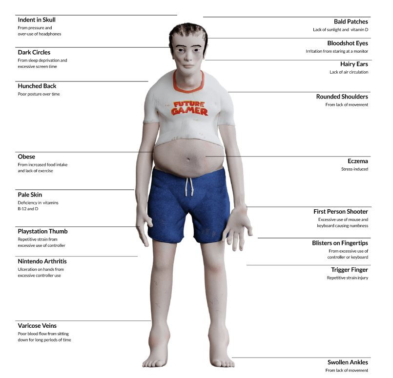 Hình ảnh phác thảo về “người nghiện game sau 20 năm” bị các game thủ chỉ trích dữ dội ảnh 3