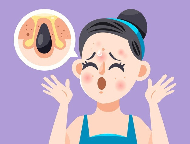 Sở hữu cả “giếng dầu” trên mặt, làm sao đây nếu bạn phải đi ra ngoài đường cả ngày? ảnh 3