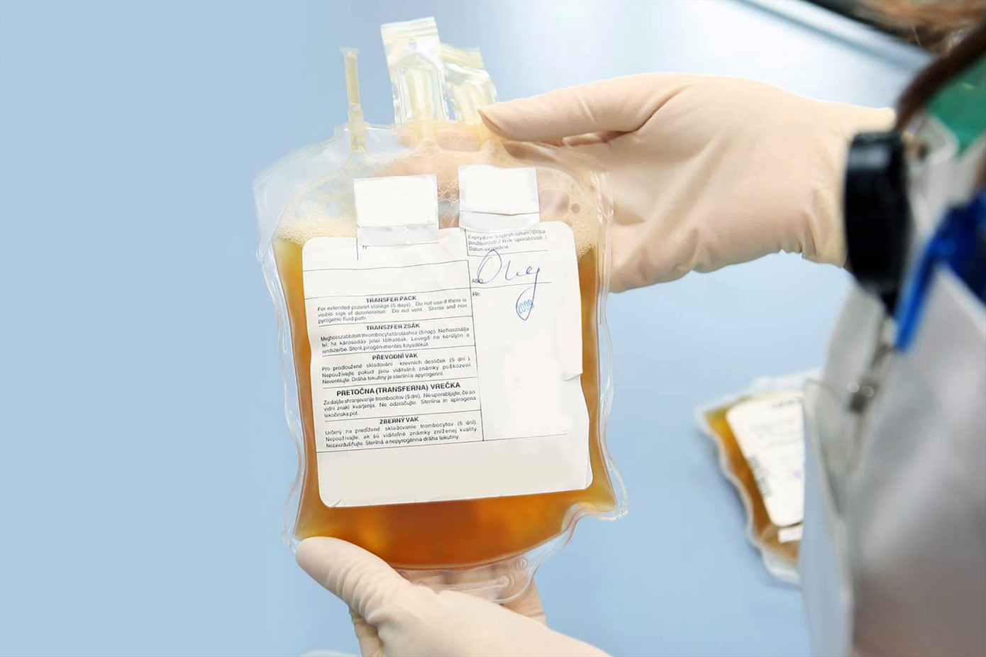 Nghiên cứu sử dụng huyết tương điều trị COVID-19 ảnh 1