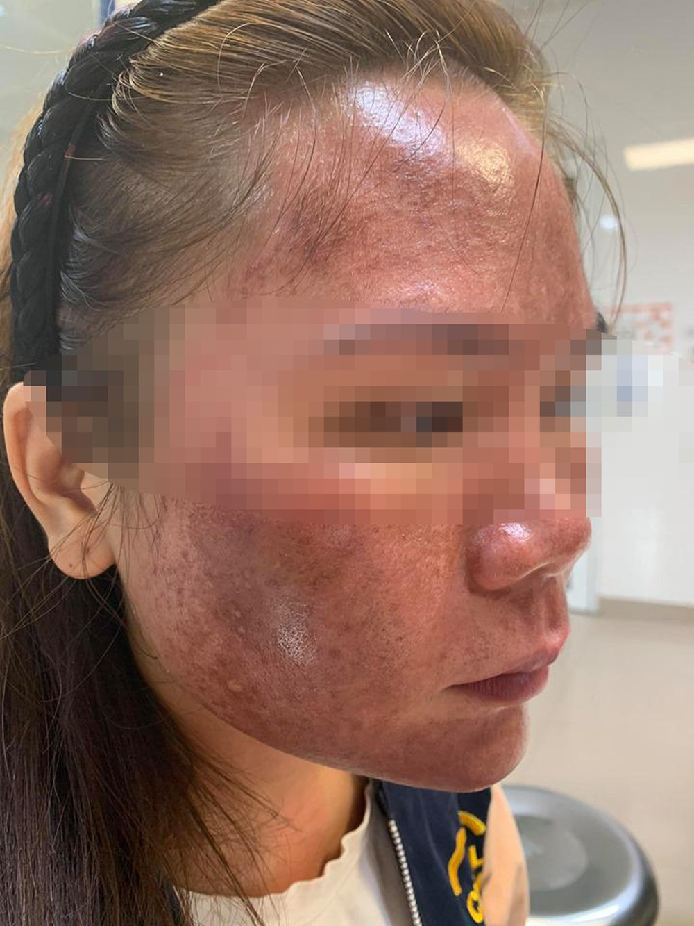 Quả đắng từ việc mua bán online mùa dịch COVID -19 ảnh 1