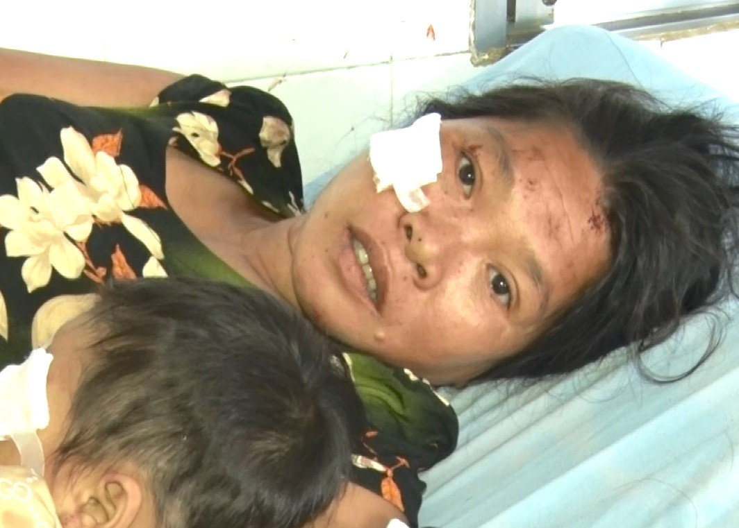 Lời kể hãi hùng của người sống sót trong vụ tai nạn thảm khốc ở Kon Tum ảnh 1