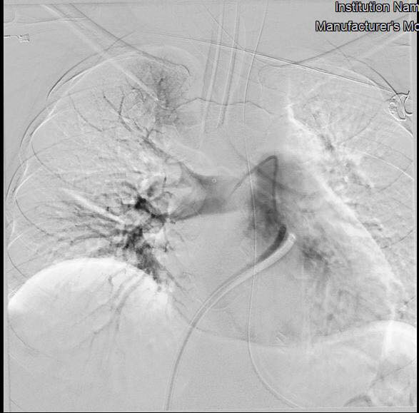 Bệnh nhân miền Tây may mắn 2 lần liên tục thoát khỏi cửa tử ảnh 1