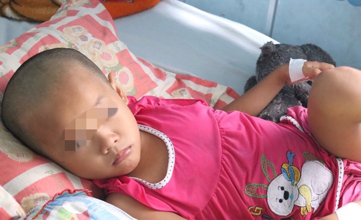 Bé gái suýt chết vì chấn thương sọ não do cha mẹ chủ quan ảnh 2