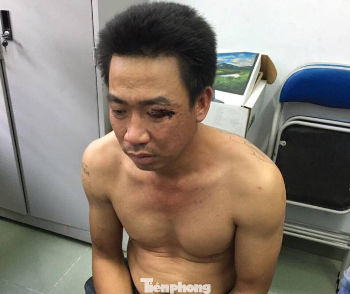 Đã bắt được tên trộm chó lái ô tô tông vào tổ tuần tra ảnh 1