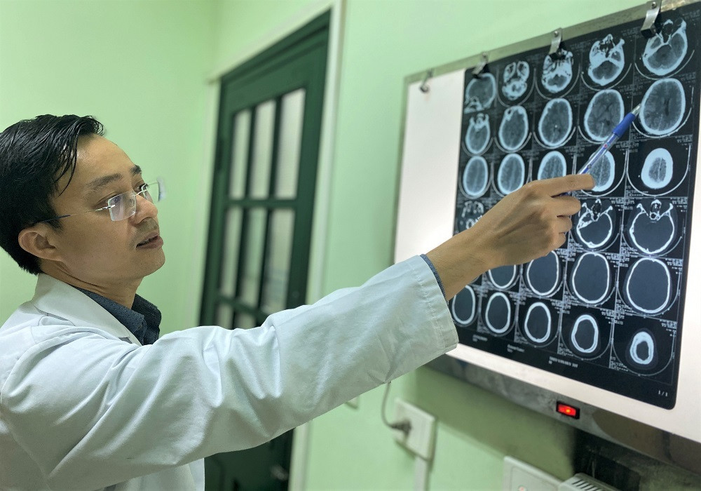 Bình ga phát nổ khi nấu ăn, nam thanh niên cụt tay, chấn thương sọ não ảnh 1